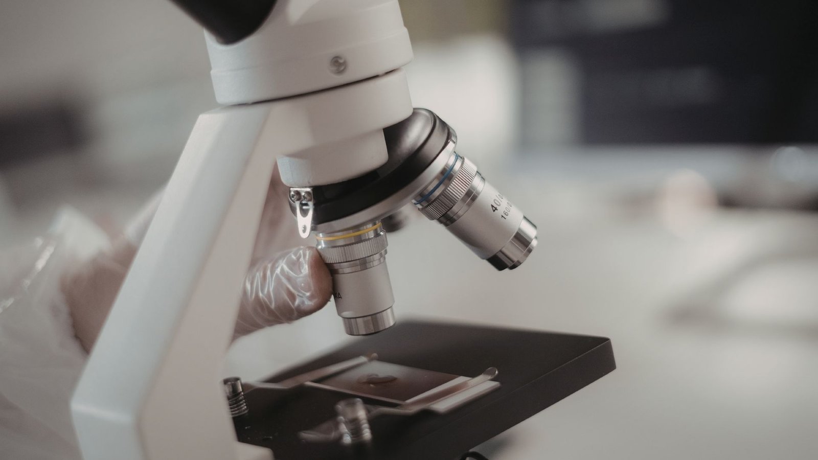 O que é a microscopia vaginal e por que ela pode mudar o seu diagnóstico ginecológico